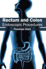 Rectum and Colon: Endoscopic Procedures