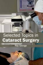 Selected Topics in Cataract Surgery