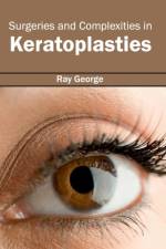 Surgeries and Complexities in Keratoplasties