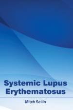 Systemic Lupus Erythematosus