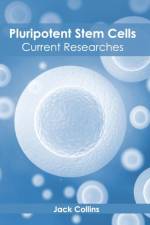 Pluripotent Stem Cells: Current Researches