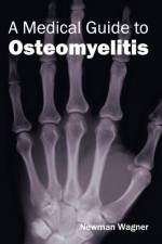 Medical Guide to Osteomyelitis