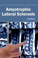 Amyotrophic Lateral Sclerosis