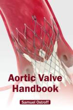 Aortic Valve Handbook