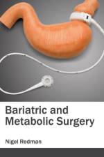 Bariatric and Metabolic Surgery