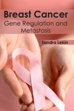 Breast Cancer: Gene Regulation and Metastasis