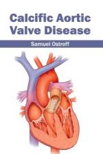 Calcific Aortic Valve Disease