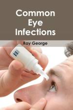 Common Eye Infections