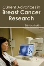 Current Advances in Breast Cancer Research