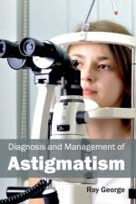 Diagnosis and Management of Astigmatism