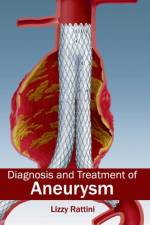 Diagnosis and Treatment of Aneurysm