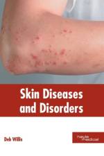 Skin Diseases and Disorders