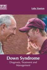 Down Syndrome: Diagnosis, Treatment and Management
