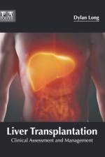 Liver Transplantation: Clinical Assessment and Management