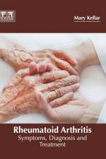 Rheumatoid Arthritis: Symptoms, Diagnosis and Treatment