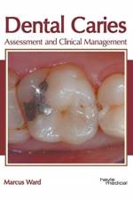 Dental Caries: Assessment and Clinical Management