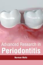 Advanced Research in Periodontitis