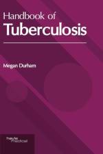 Handbook of Tuberculosis