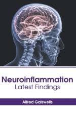 Neuroinflammation: Latest Findings