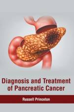 Diagnosis and Treatment of Pancreatic Cancer