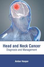 Head and Neck Cancer: Diagnosis and Management