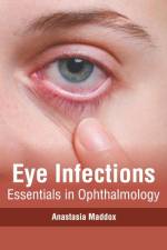 Eye Infections: Essentials in Ophthalmology