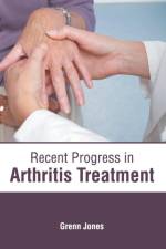 Recent Progress in Arthritis Treatment