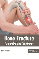 Bone Fracture: Evaluation and Treatment