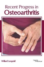 Recent Progress in Osteoarthritis