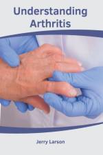 Understanding Arthritis