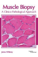 Muscle Biopsy: A Clinico-Pathological Approach