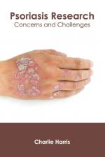 Psoriasis Research: Concerns and Challenges
