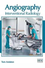 Angiography: Interventional Radiology