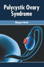 Polycystic Ovary Syndrome