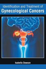 Identification and Treatment of Gynecological Cancers