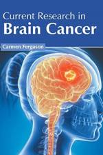 Current Research in Brain Cancer