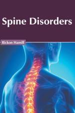 Spine Disorders