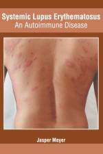 Systemic Lupus Erythematosus: An Autoimmune Disease