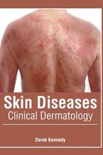 Skin Diseases: Clinical Dermatology