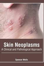 Skin Neoplasms: A Clinical and Pathological Approach