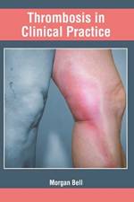 Thrombosis in Clinical Practice