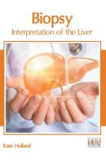 Biopsy: Interpretation of the Liver