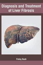 Diagnosis and Treatment of Liver Fibrosis