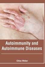 Autoimmunity and Autoimmune Diseases
