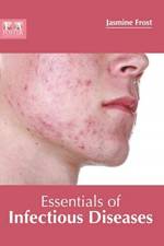 Essentials of Infectious Diseases
