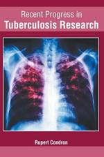 Recent Progress in Tuberculosis Research