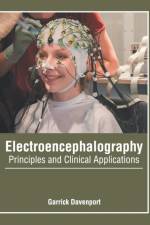 Electroencephalography: Principles and Clinical Applications