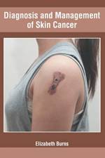 Diagnosis and Management of Skin Cancer
