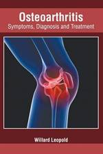 Osteoarthritis: Symptoms, Diagnosis and Treatment