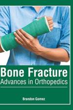 Bone Fracture: Advances in Orthopedics